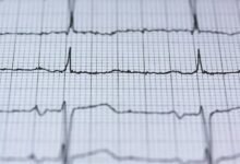 fusion pulse market node